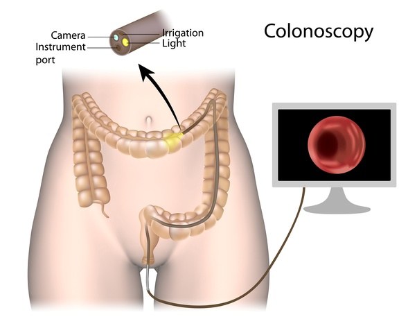 Copycat reccomend Causes of bleeding from anus